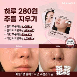 더링끌레 링클 리셋 팔자주름 패치 1+1+1 솔직 후기 | 피부 타입별 분석 - 상품 이미지 3