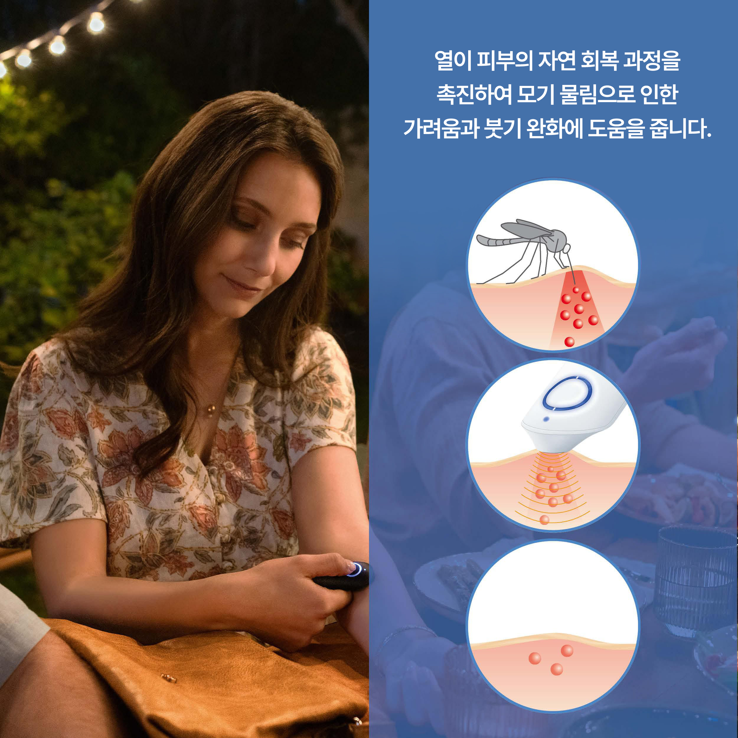 보이러 BiteX BR90 모기물림 가려움 완화기 이미지 6