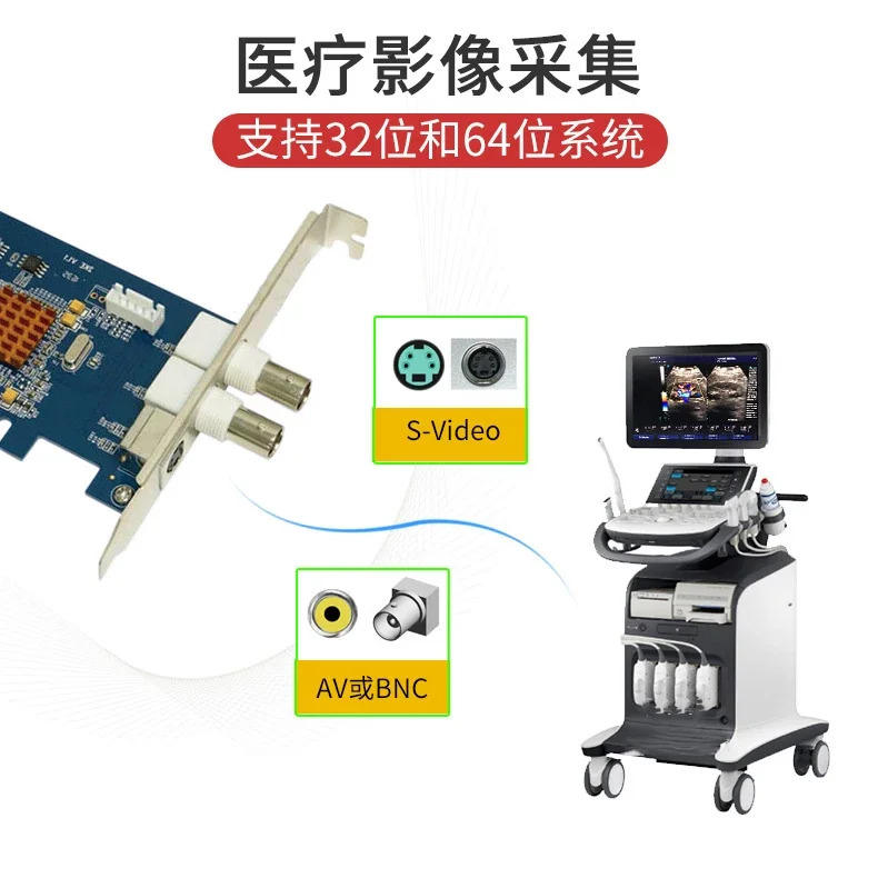 Zhongan Video SV2000E 표준 화질 아날로그 수집 카드 PCI E 이미지 B-초음파 SV/