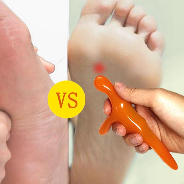 발바닥 마사지기 발 마사지 도구 스틱 수면 개선 - 상품 이미지