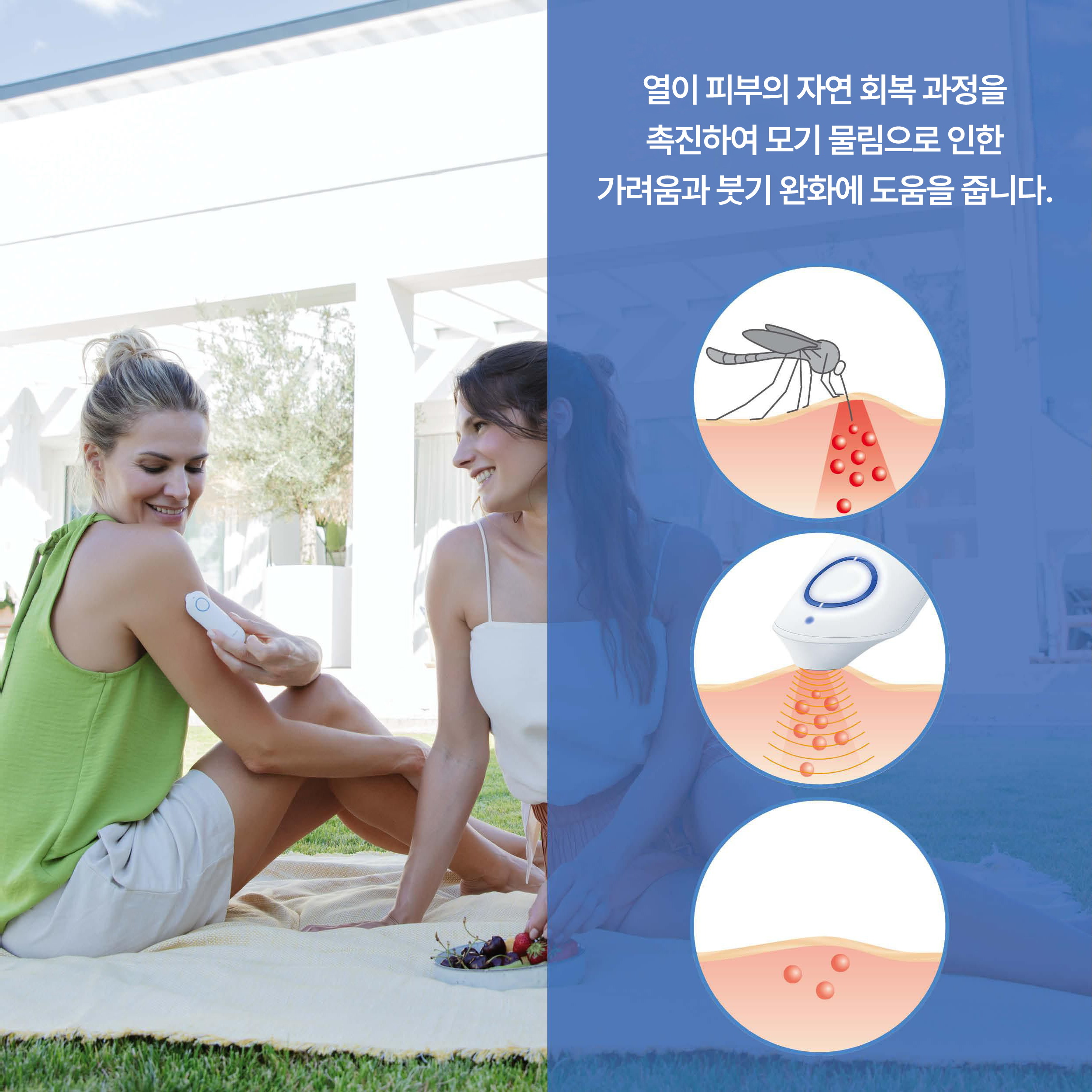 보이러 BiteX BR60 모기물림 가려움 완화기 이미지 6