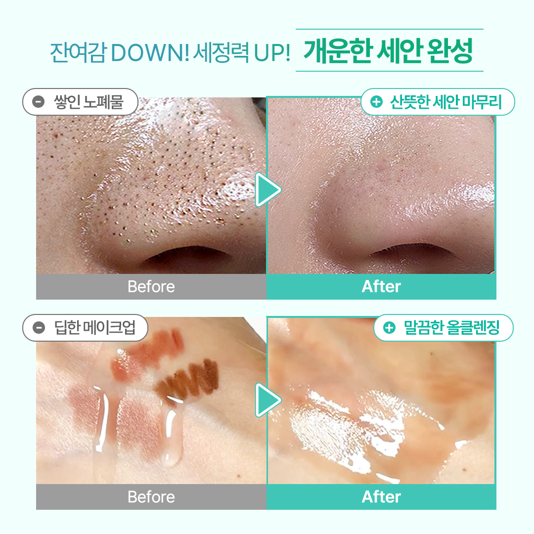 오미티드 민감성 피부 블랙헤드 모공 케어 LHA 딥클렌징 오일 200ml, 1개 이미지 3