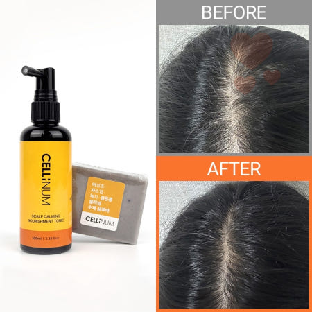 두피케어세트 수제샴푸바 고체샴푸 지성샴푸바