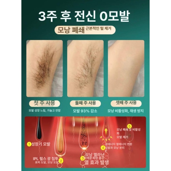 프리미엄 사파이어 동결점 제모기 가정용 특수 레이저 FDA 인증 의료용 제모기선물 패키지 FDA 인증 의료용 제모기선물 패키지 - 상세 이미지 3