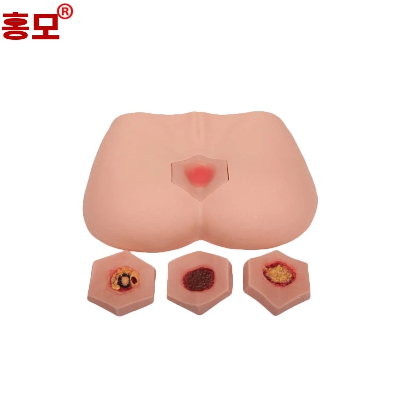 욕창 더미 모형 모델 A. 홍모 HOM0B 단계 욕창 간호 모형 노인 케어 교육 모형 4단계 욕창 간호 교육 모형 욕창 간호 교육 모형 시뮬레이터 - 상세 이미지 5