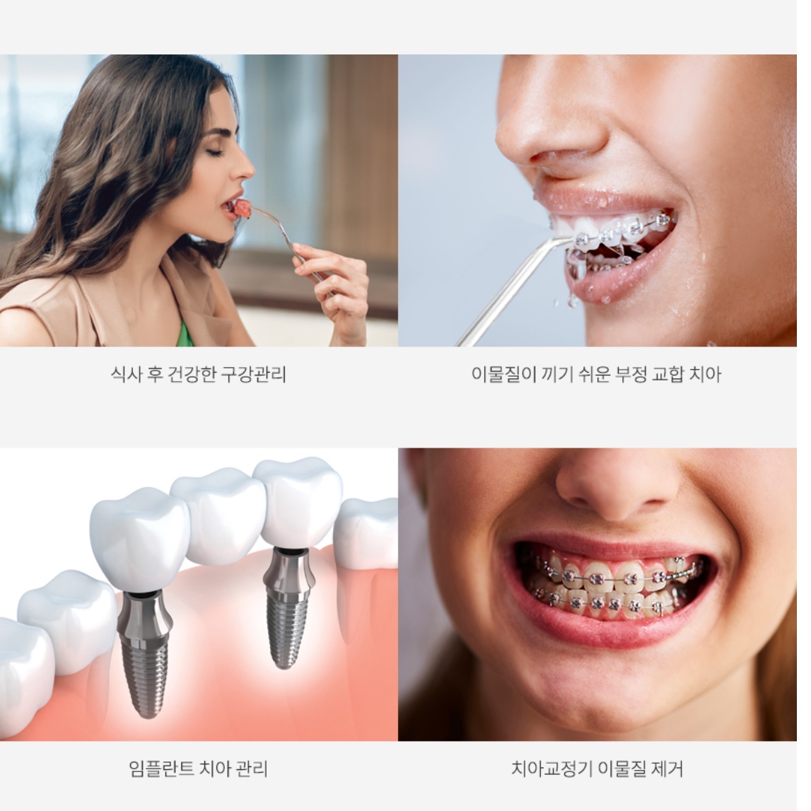 물 양치 치아 청소기 잇몸 세척 수압 치솔 잇몸 청소 - 상세 이미지 2