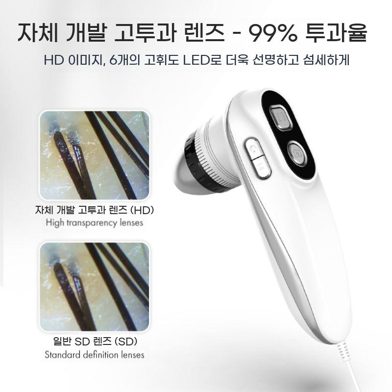 두피진단기 카메라 11인치 모니터 모발진단기 미용실 피부관리실 두피현미경 - 상세 이미지 3