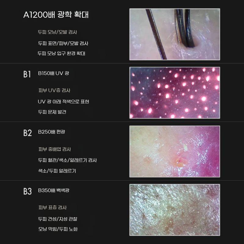 두피진단기 카메라 11인치 모니터 모발진단기 미용실 피부관리실 두피현미경 - 상세 이미지 5