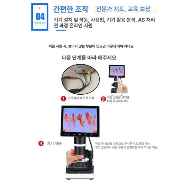 정밀 혈관 분석기 말초신경 모세혈관 검출기 고화질 말초 장비 스크린 없는 HD - 상품 이미지