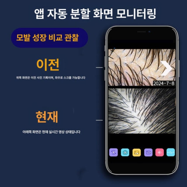 프리미엄 두피마사지기 전기 빗 액체 도포 마사지기 고화질 헤드 케어 진동 두피관리기 두피마사지기계 두피마사지기기 전동두피마사지 화이트 라이트 럭셔리 에디션 100W - 상세 이미지 3