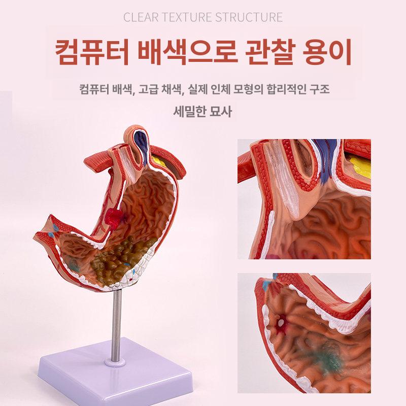 위장 모형 신체 장기 해부학 실습 내장 의학 교육용 대형 - 상세 이미지 5