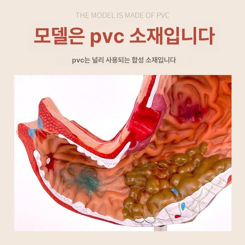 위장 모형 신체 장기 해부학 실습 내장 의학 교육용 대형 - 상세 이미지 4