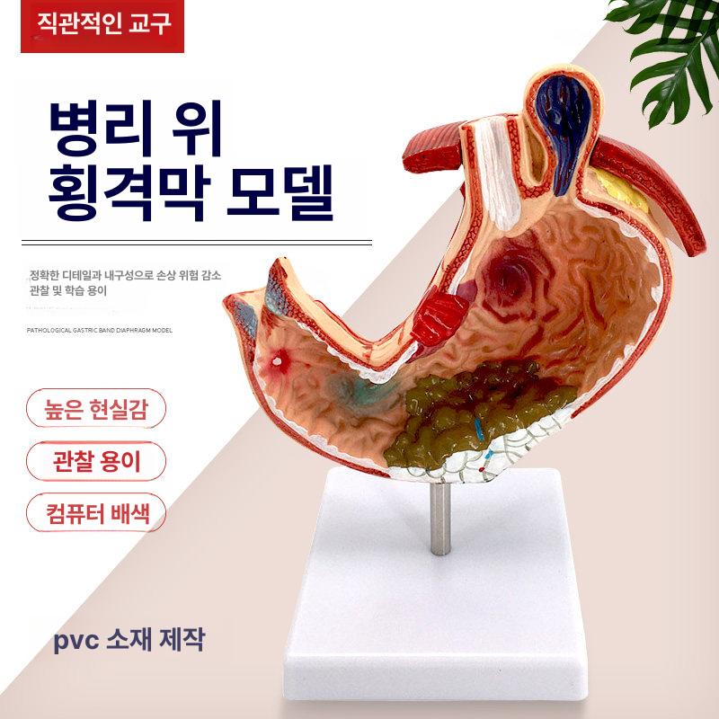 위장 모형 신체 장기 해부학 실습 내장 의학 교육용 대형 - 상세 이미지 2