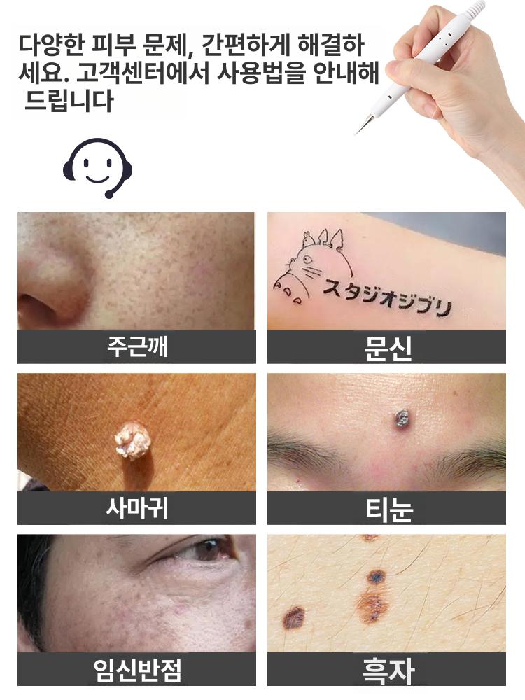 점제거펜 레이저 기계 바디 케어 휴대용 좁쌀 스팟 제거기 - 상세 이미지 3