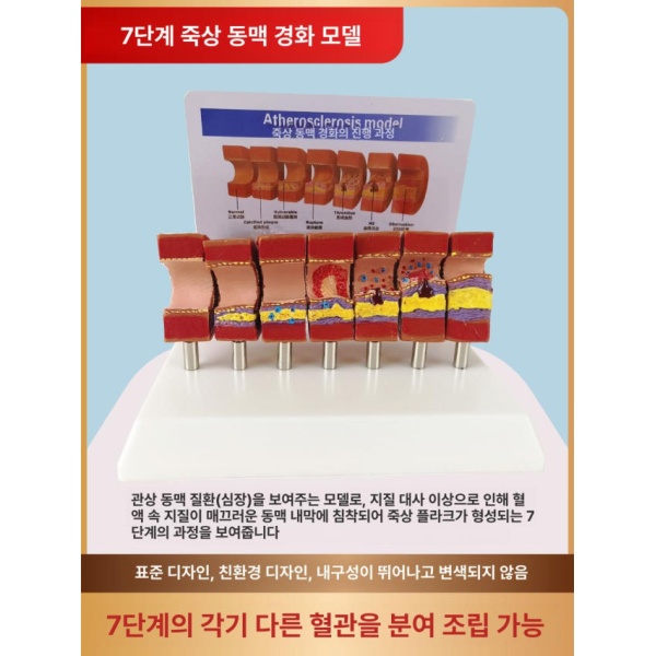 정밀 의대 교육용 혈관모형 해부학 보건 동맥 경화 혈전 단일 항목 단일 항목 - 상세 이미지 2
