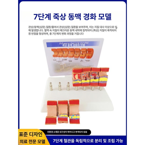정밀 의대 교육용 혈관모형 해부학 보건 동맥 경화 혈전 단일 항목 단일 항목 - 상세 이미지 5