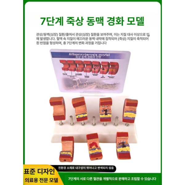 정밀 의대 교육용 혈관모형 해부학 보건 동맥 경화 혈전 단일 항목 단일 항목 - 상세 이미지 4