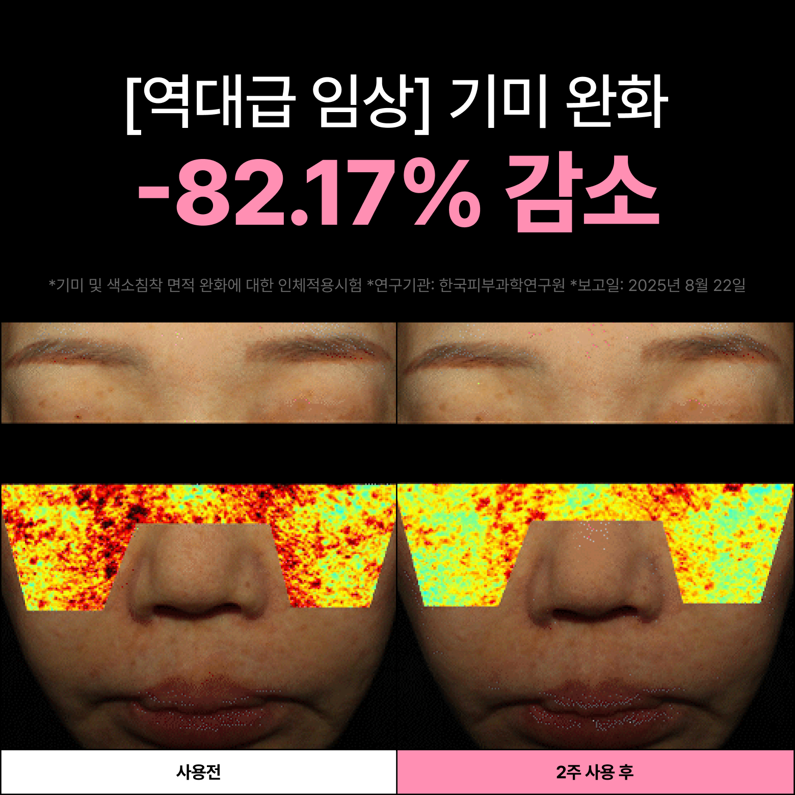 핑크기미크림 약국 미백 멜라닌크림 멜라논멜라토닝 기미잡티 제거 언코드 30ml, 1개 이미지 2