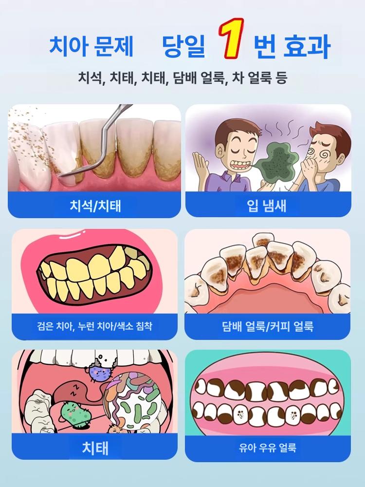 가정용 초음파 구강 스케일링 세척기 물치실 클리너 엘레강트블루 시각화 최고급 모델 6900W - 상세 이미지 2