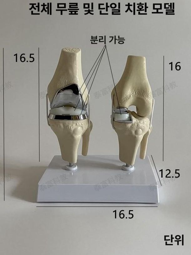 무릎관절 모형 부분치환술 인체 인공 골격 훈련 전신 무릎+단일 무릎 교체 - 상세 이미지 2