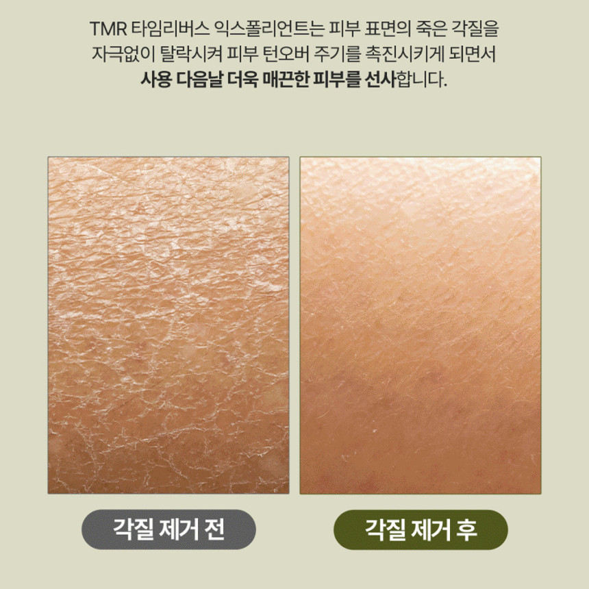 AHA 각질제거 필링 BHA 크림 블랙헤드 피지 녹이는 제품 필링제 클리너 아하 바하 얼굴