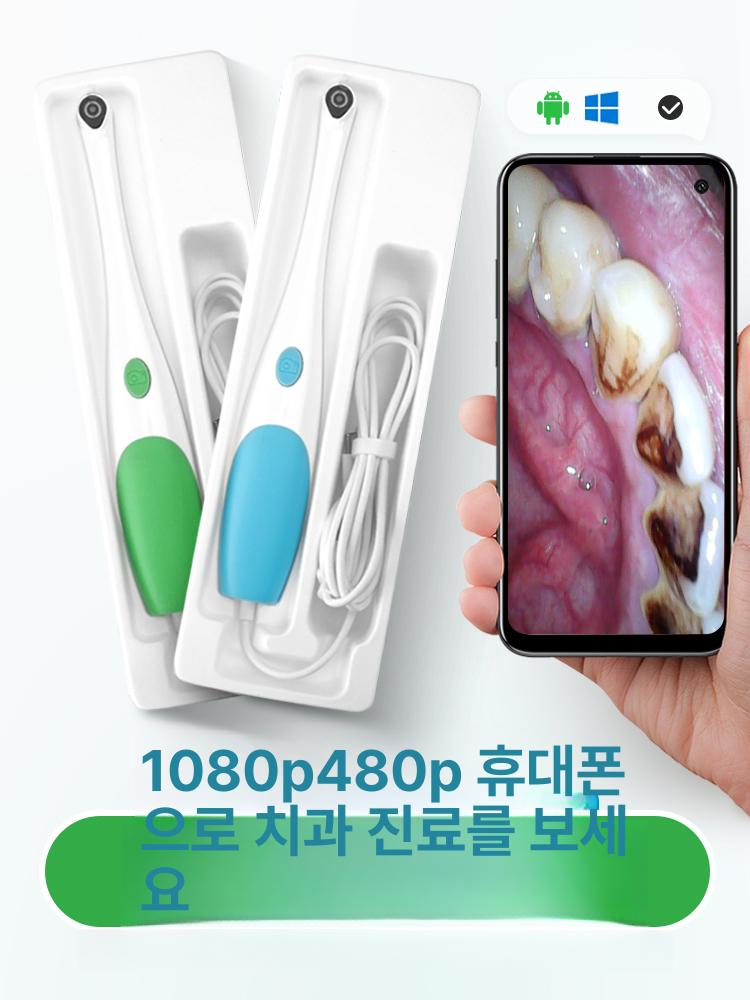 구강 카메라 투명 점검 모바일 셀프 치아 휴대폰 전송 AppleAndroid 초고화질 치과용 1박스 - 상세 이미지 2