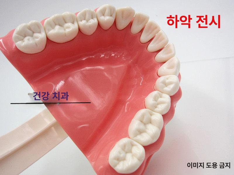 치아모형 이모형 구강 인체 디스플레이 충치 교육용 1 1 소형 - 상세 이미지 5