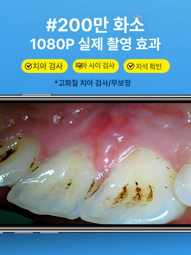 구강 카메라 투명 점검 모바일 셀프 치아 휴대폰 전송 AppleAndroid 초고화질 치과용 1박스 - 상세 이미지 5