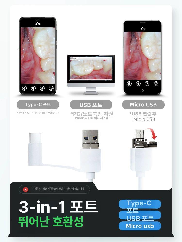 구강 카메라 투명 점검 모바일 셀프 치아 휴대폰 전송 AppleAndroid 초고화질 치과용 1박스 - 상세 이미지 3