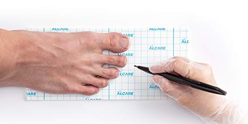 알케어 발용 면하 펠트 반창고 프리컷 시트 20781