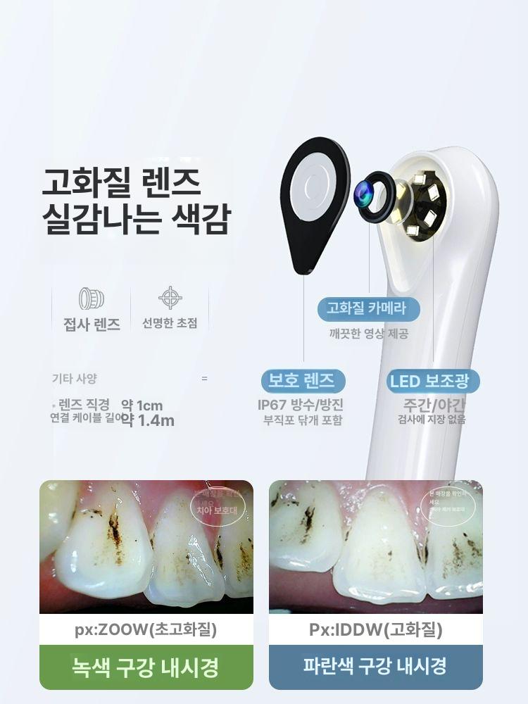 구강 치아 카메라 장비 관찰 입속 고화질 관리 의사 안드로이드전용 그린 울트라클리어 1박스 - 상세 이미지 3