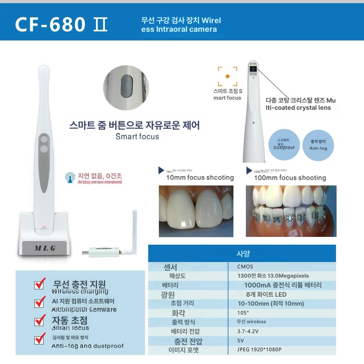 고화질 구강 내시경 치아 치과카메라 멀티미디어 무선 줄무늬 4K 전면 치과 치과 관리자 E 뷰 - 상세 이미지 2