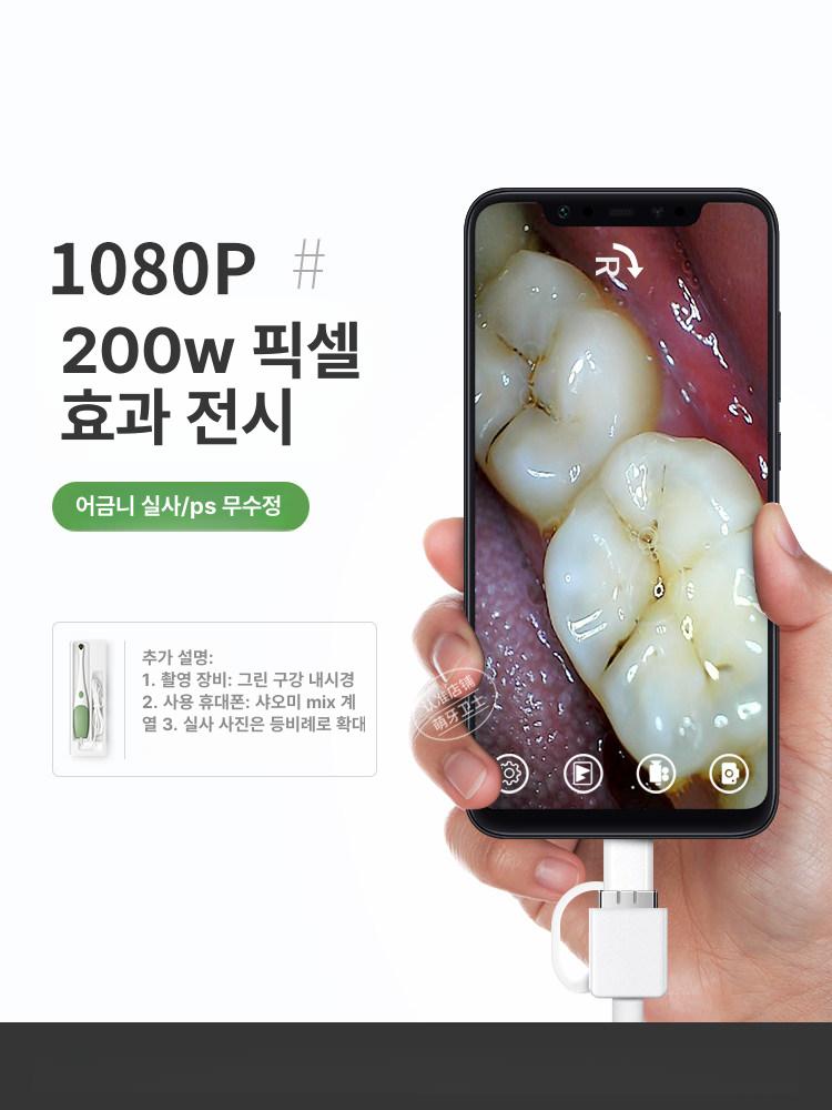 구강 치아 카메라 장비 관찰 입속 고화질 관리 의사 안드로이드전용 그린 울트라클리어 1박스 - 상세 이미지 4