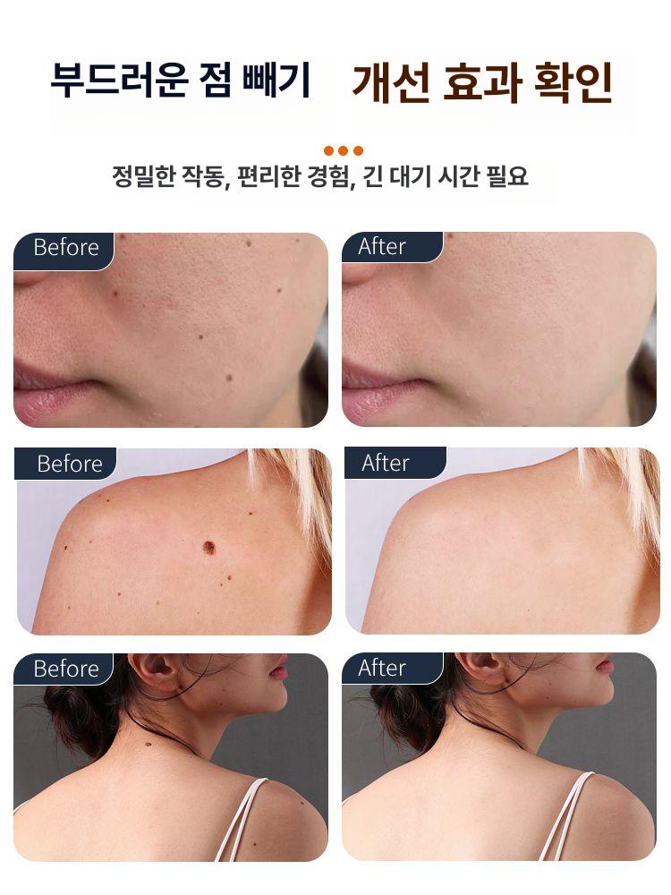 미용실 전용 전기 이온 미용기기 가정용 점 제거기 - 상세 이미지 4