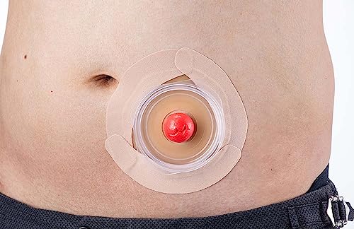 알케어 장루용 장구 고정 테이프 파우치 액세서리 면판 보강 테이프 메쿠레 가드 테이프 21011