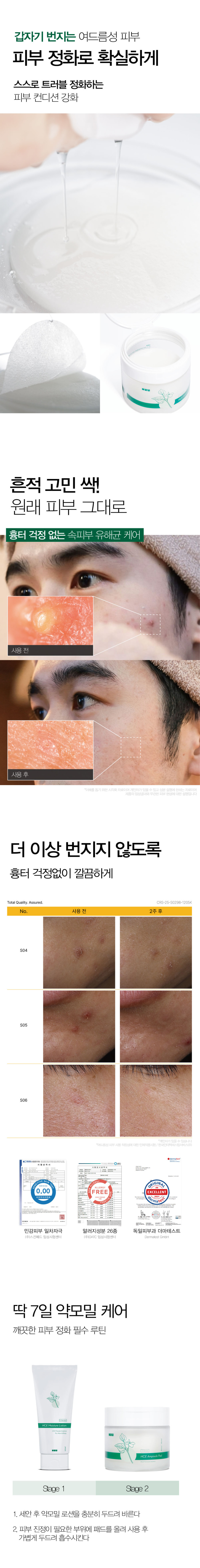 일센치 약모밀 로션+패드 아기 청소년 민감성 성인 판매처 상세 정보 이미지 3