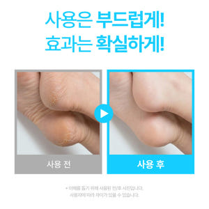 발 각질연화제 풋케어 발각질제거제 스크럽 풋스크럽 솔직 후기 | 피부 타입별 분석 - 상품 이미지 2