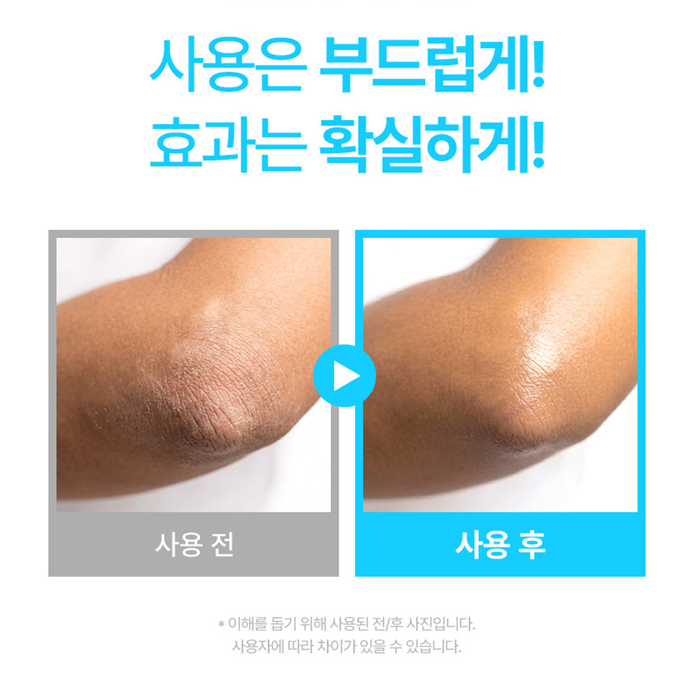 때필링 팔꿈치 각질 제거 다리 바디 각질제거제 필링 젤 - 상세 이미지 2