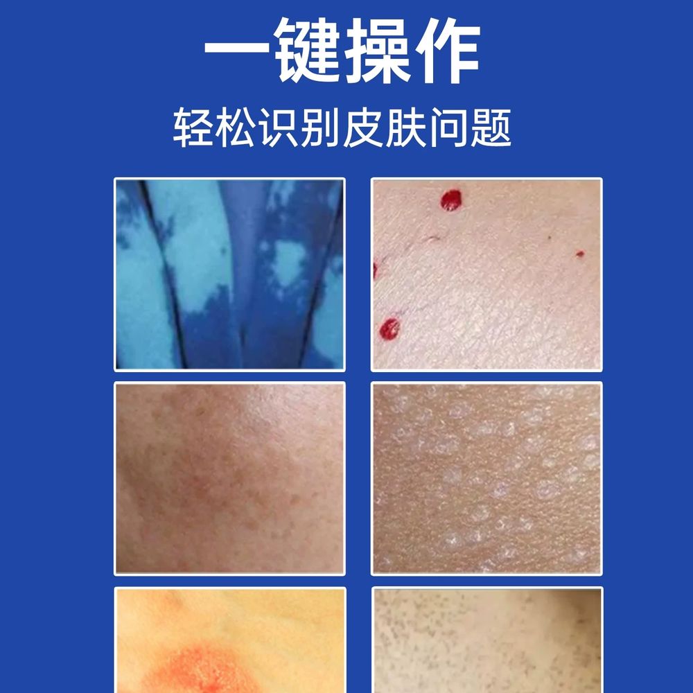 자외선 우드램프 검사 피부검사 확대경 UV A. 의료용 12구 전원 연결식 UV 필터 없음 - 상세 이미지 4
