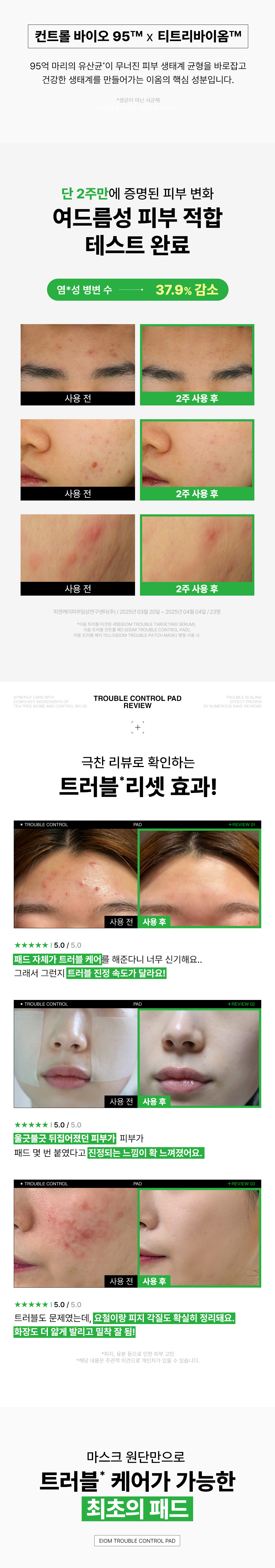 EIOM Trouble Line Duo Set - details 25