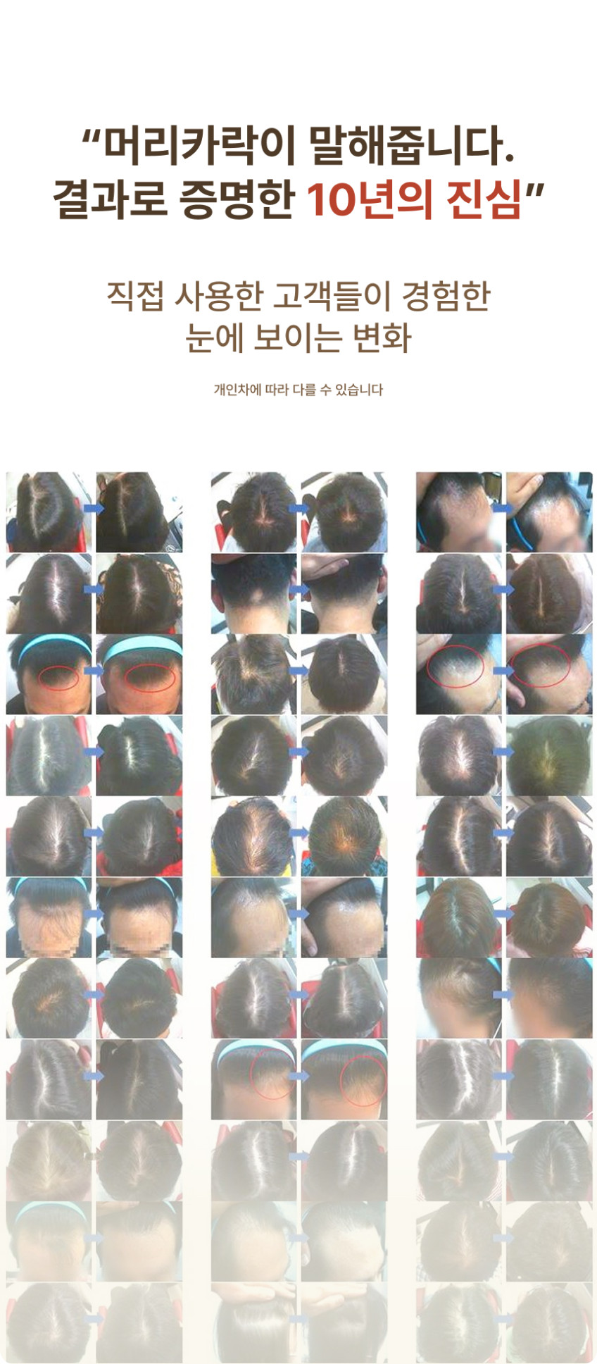 플러스칼프 어드밴스드 비타민C 헤어토닉 두피케어 쿨링 두피각질케어 판매처 상세 정보 이미지 3