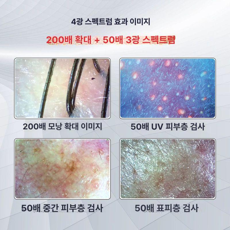 두피진단기 11인치모니터 두피카메라 스캐너 두피현미경 15.5인치 이미지 저장 4구간 비교 - 상세 이미지 5