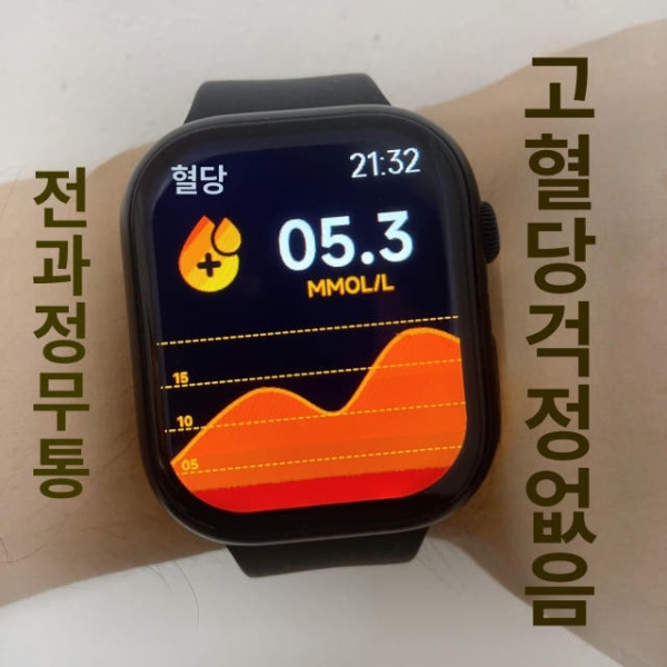 프리미엄 스마트워치 혈당 심박수 지질 소변 수면 운동 모니터 연속혈당측정기 고정밀 혈압 - 상세 이미지 3