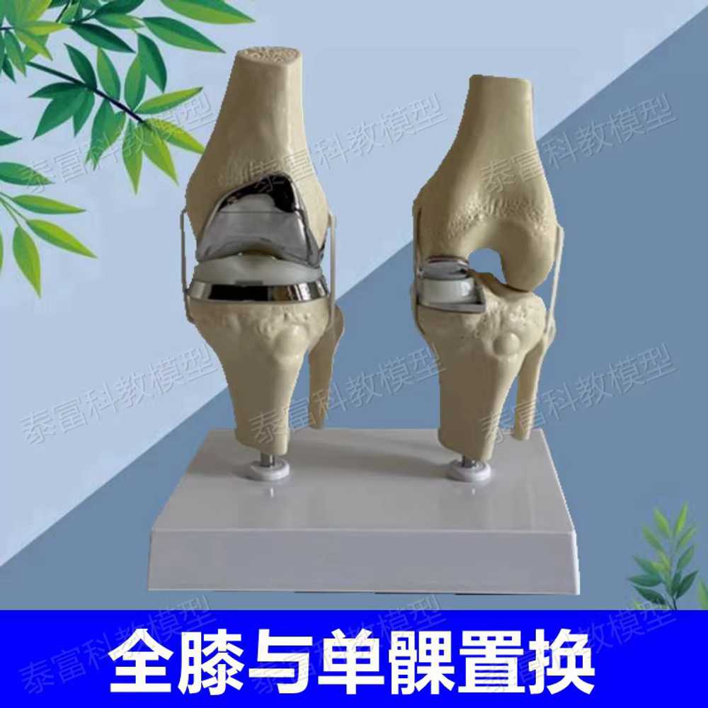무릎관절 모형 부분치환술 실습 교육 병원 인체모형 부분 - 상세 이미지 2