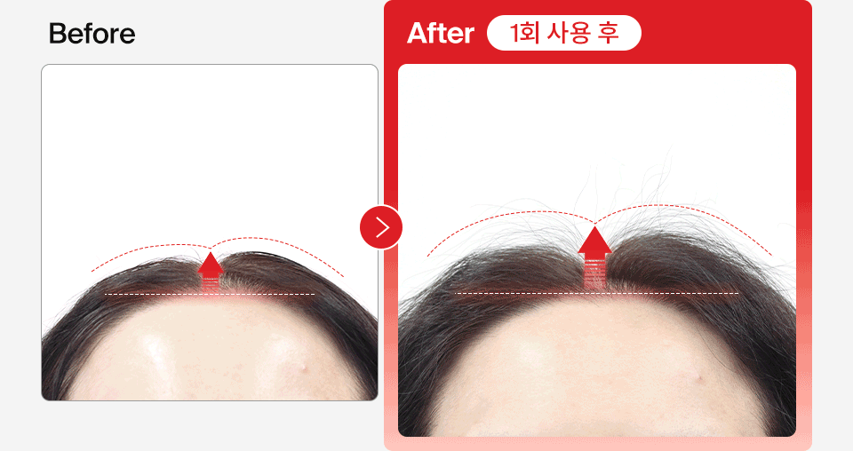 DR.FORHAIR Folligen Thickening Shampoo - details 16