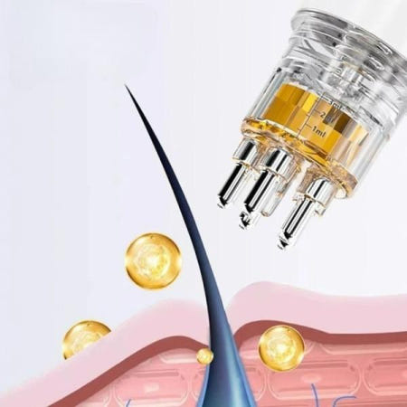 헤어토닉도포기 헤어 토닉 도포기 로게인폼 미녹시딜 두피 마이녹실