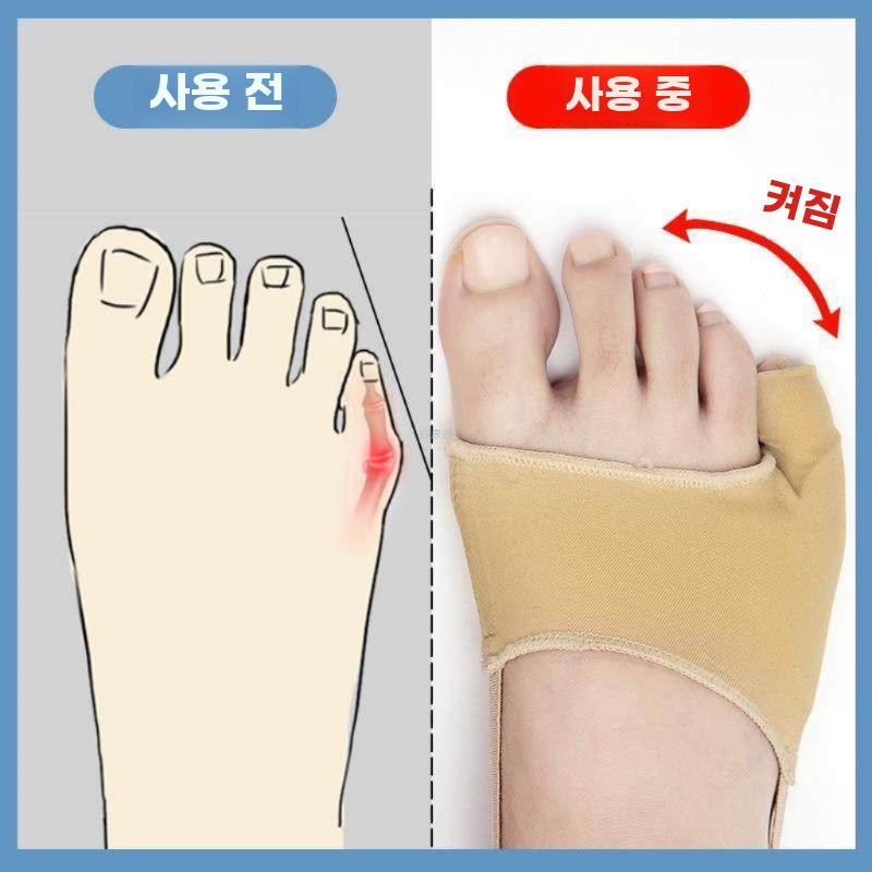 새끼발가락 교정기 휜발가락 교정 밴드 외반증 보조기 새끼발가락 피부톤 S - 상세 이미지 3