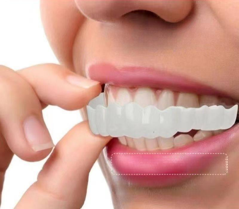 인조이빨 인공 치아 건치 틀니 가짜 실리콘 보조 임시 [상치+하치+두충 젤] - 상품 이미지