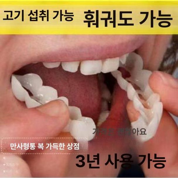 인조이빨 인공 치아 건치 틀니 가짜 실리콘 보조 임시 [상치+하치+두충 젤] - 상세 이미지 5