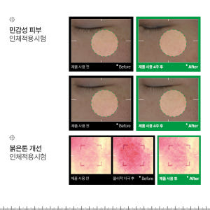 인포디플러스 엑세스피316 선크림 30ml, 1개 솔직 후기 | 피부 타입별 분석 - 상품 이미지 2